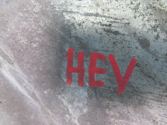 99-00 VW Eurovan T4 2.8L Engine Motor Upper Timing Chain  Plate Cover OEM